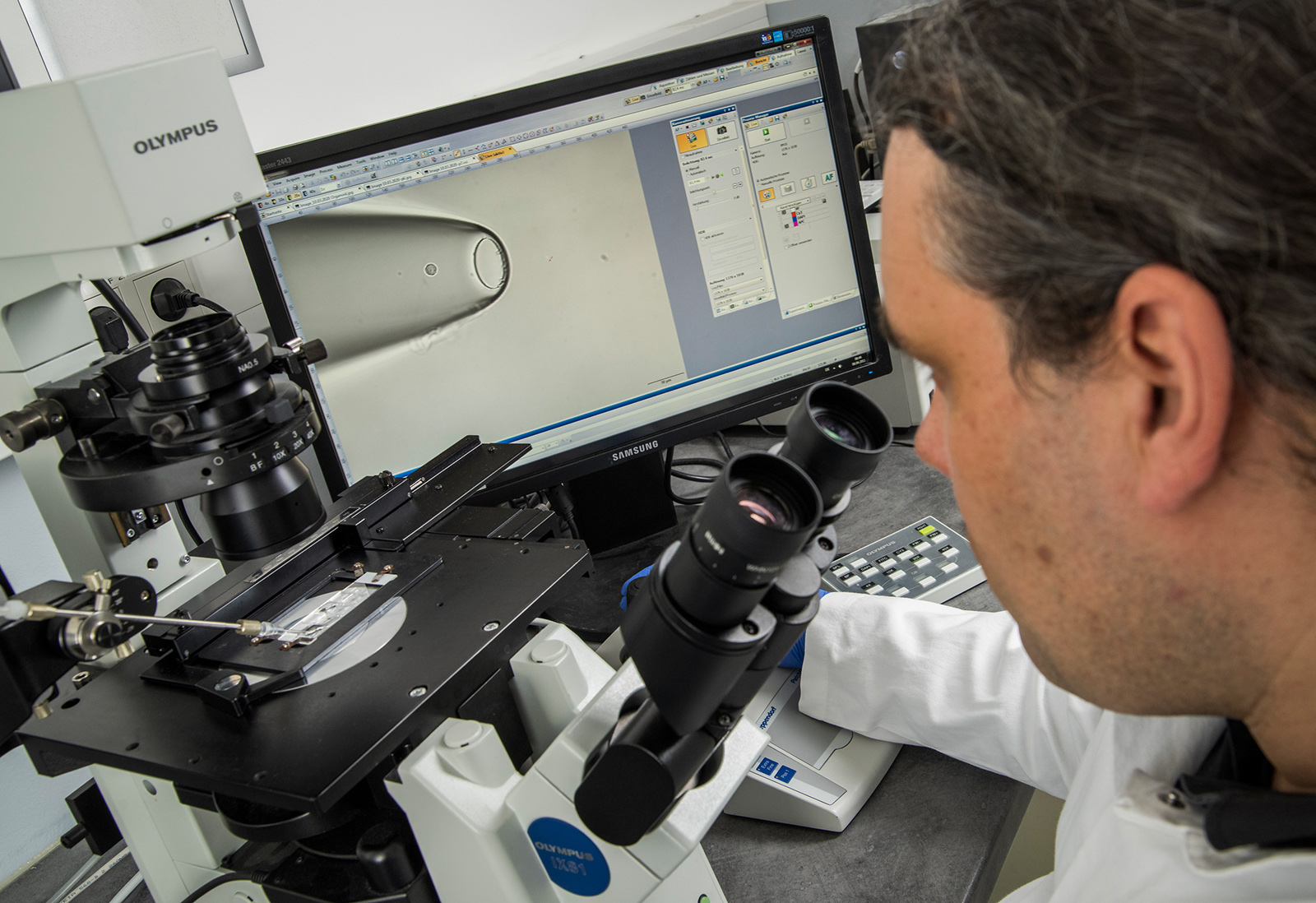 Am Mikroskop isoliert Bernhard Polzer einzelne Krebszellen, welche er zuvor aus Patientenmaterial gewonnen hat. Auf dem Monitor erkennt man die Glaskapillare mit der Zelle, die er im Vorfeld als Krebszelle identifiziert und danach vom Objektträger aufgesaugt hat. 