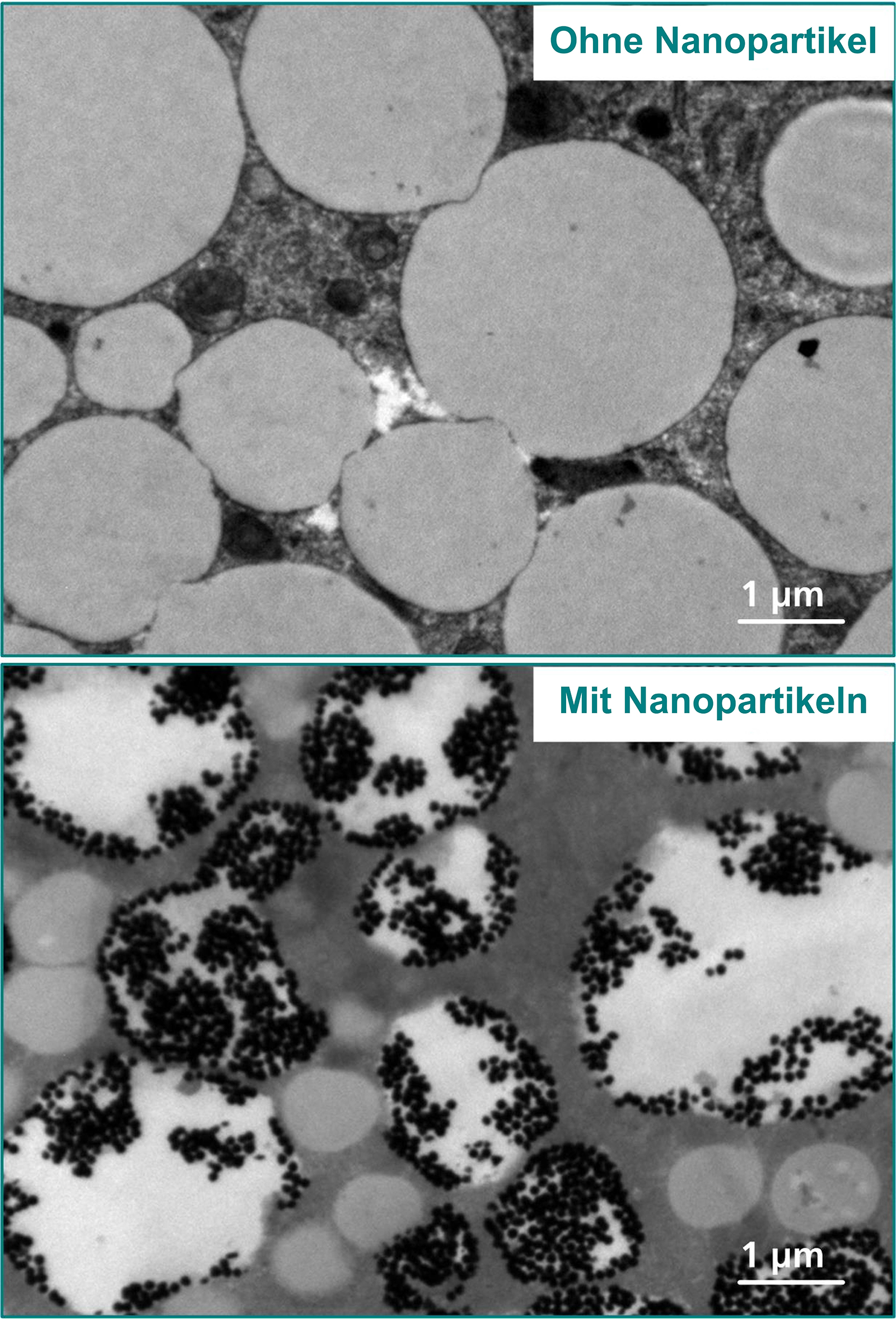 Ausschnitt einer mikroskopischen Aufnahme einer menschlichen Fettzelle: oben unbehandelt, unten mit Gold-Nanopartikeln versetzt. Die Teilchen reichern sich in den Fetttropfen der Zelle an.