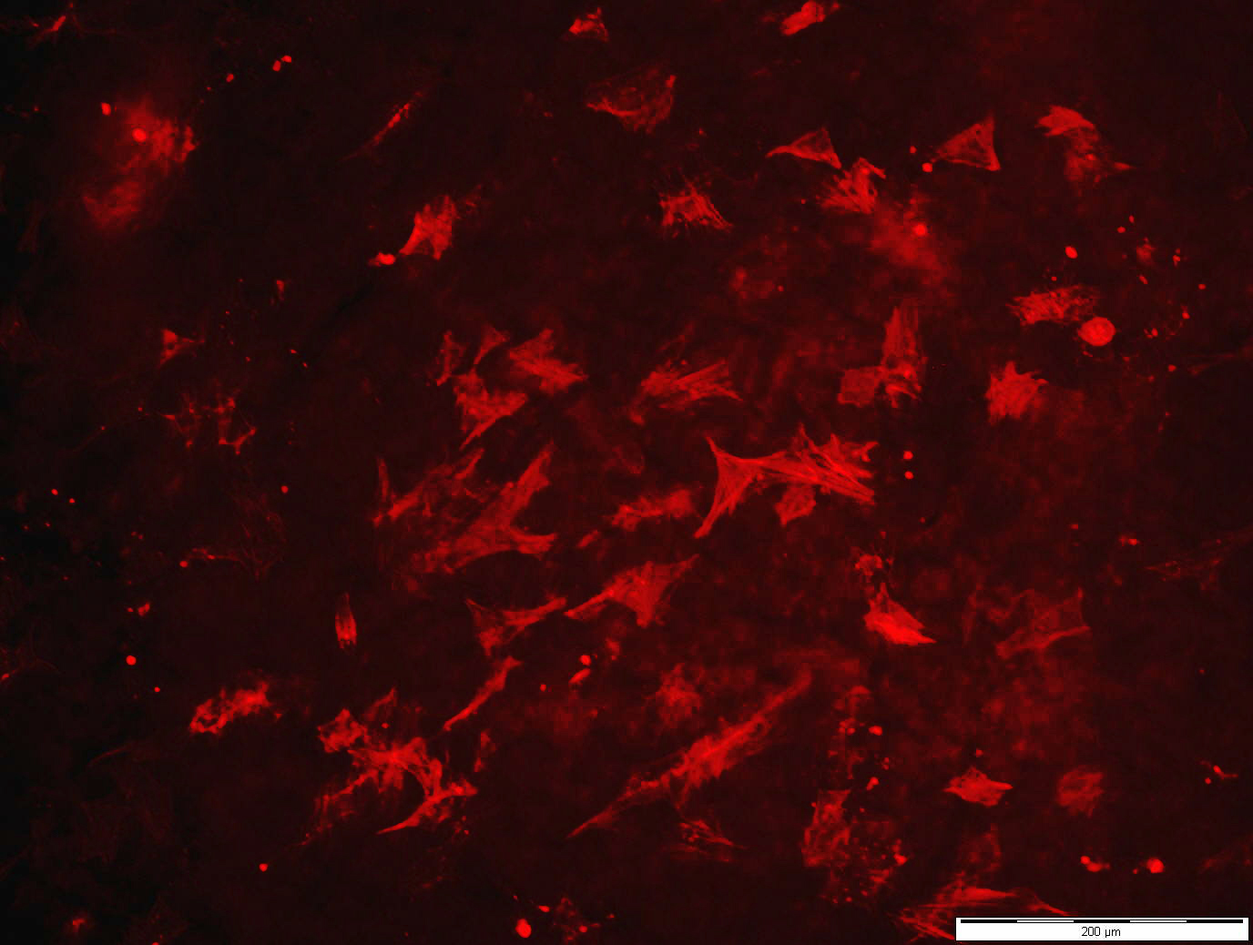 Humane Fibroblasten-Zellkultur, ausgesät auf einem Schweineherzbeutel, der mit Glutaraldehyd chemisch vernetzt wurde. Die Zellen reagieren auf Reste der toxischen Chemikalie, indem nur wenige von ihnen anwachsen.