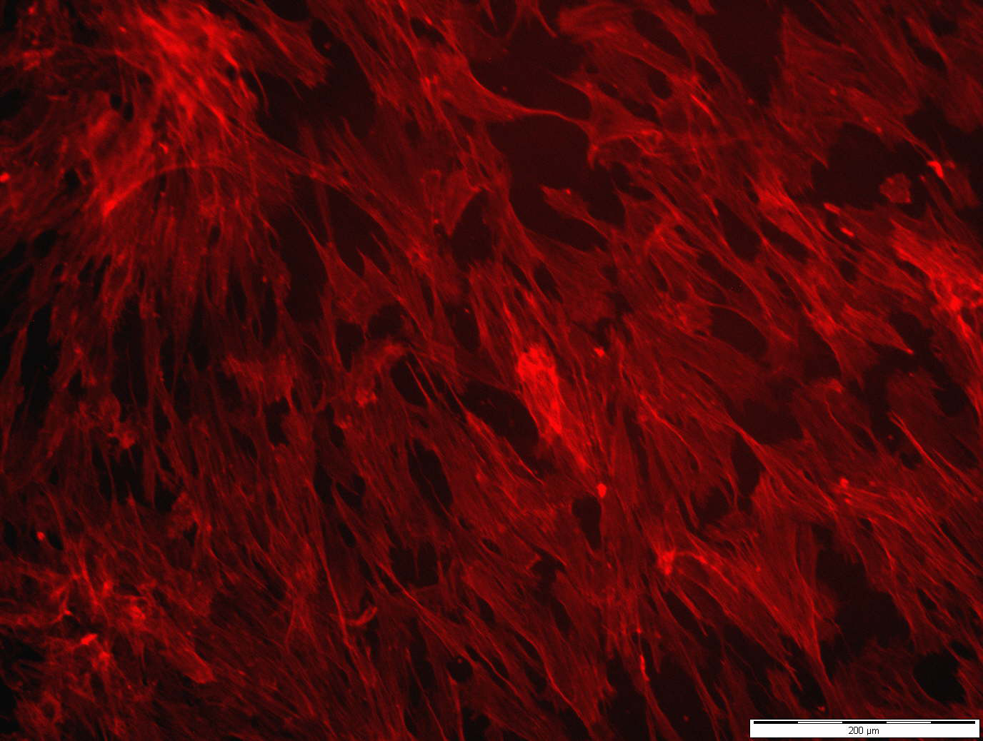 Humane Fibroblasten-Zellkultur, ausgesät auf einem Schweineherzbeutel, der per Elektronenstrahl vernetzt wurde. Auf dem zytokompatiblen Herzbeutel wachsen mehr Zellen an und vermehren sich dort.