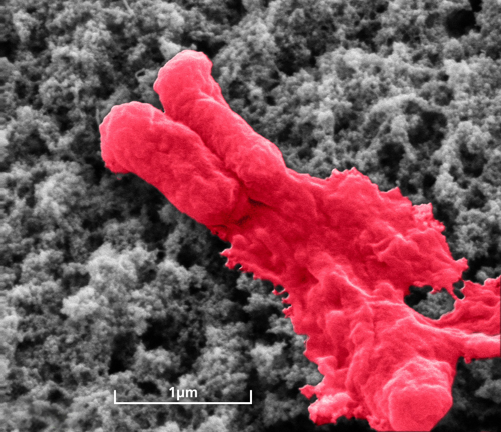 Antibiotikabeschichtung lysiert Bakterium (E.coli).