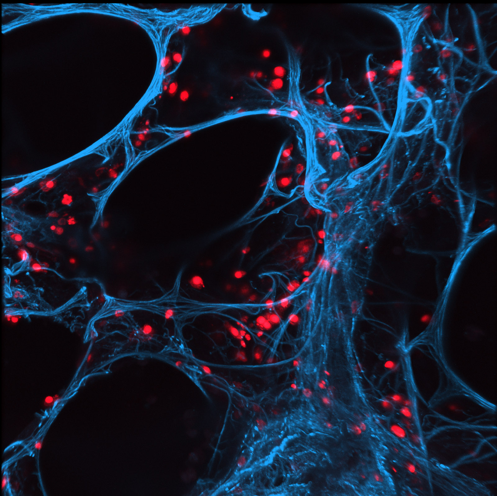 Für den Nachweis der Wirksamkeit neuer Wirkstoffe nutzen Fraunhofer-Wissenschaftler auch lebende menschliche Lungengewebsschnitte, sogenannte Precision-Cut Lung Slices (blau), die wie hier mit Grippeviren (rot) infiziert werden können.