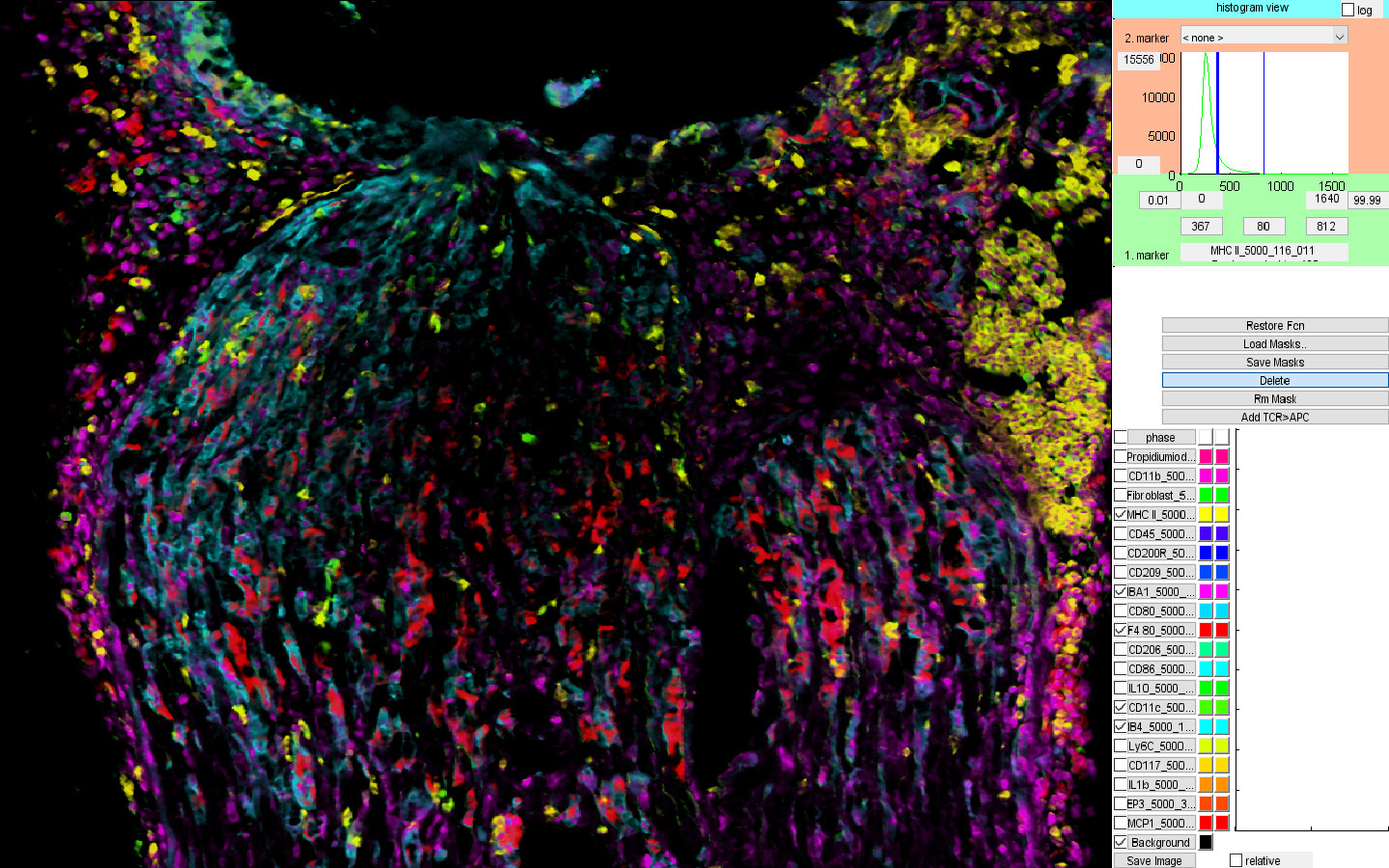 Fluoreszenzaufnahme von verschiedenen Immunzellen bei der Reparatur des verletzten Ischiasnerven.