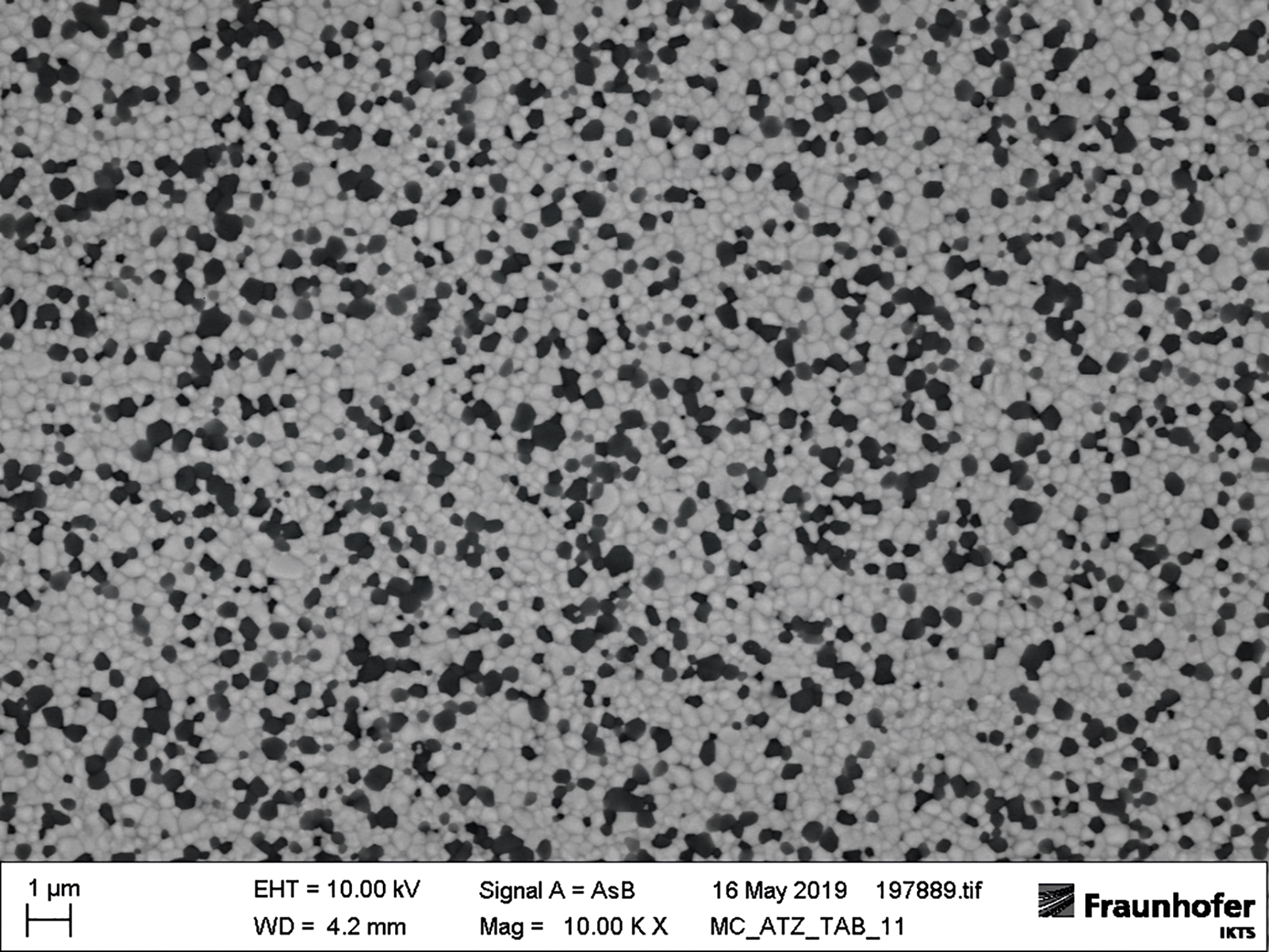 Keramik-Gefüge einer ATZ-Dispersions-Keramik unter dem Mikroskop. Die gleichmäßige Verteilung der Partikel ist entscheidend für Qualitätseigenschaften wie Festigkeit und Langlebigkeit der Prothese.