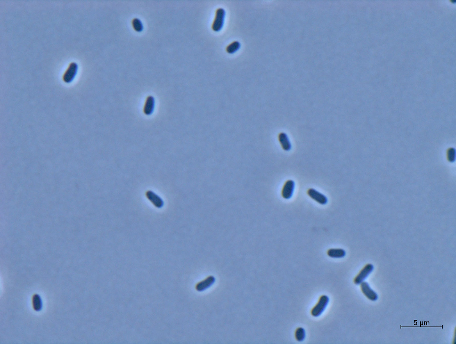 Lichtmikroskopische Aufnahme von Zellen des gram-negativen Bakteriums Methylorubrum extorquens AM1.