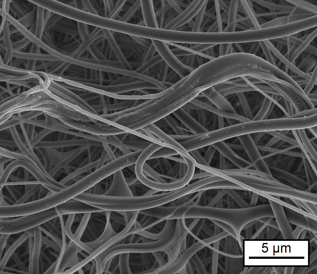 Mikrostruktur eines Tropoelastin-Vlieses, das mit Formaldehyd vernetzt worden ist (Aufnahme im Rasterelektronenmikroskop). 