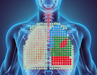 Die visuelle Darstellung zeigt die unterschiedlichen Bereiche der Lunge und ihre Belüftungssituation. Rot steht für schlechter belüftete Bereiche.