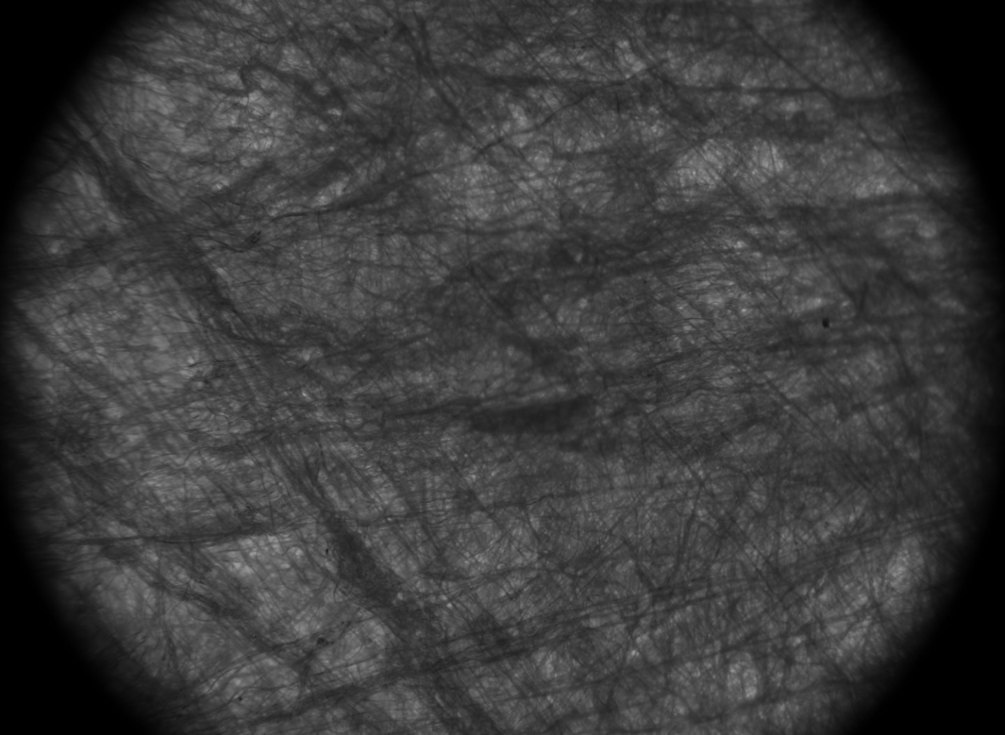 Die Durchlichtaufnahme aus dem Mikroskop zeigt die Verteilung der Fasern im Vliesstoff.