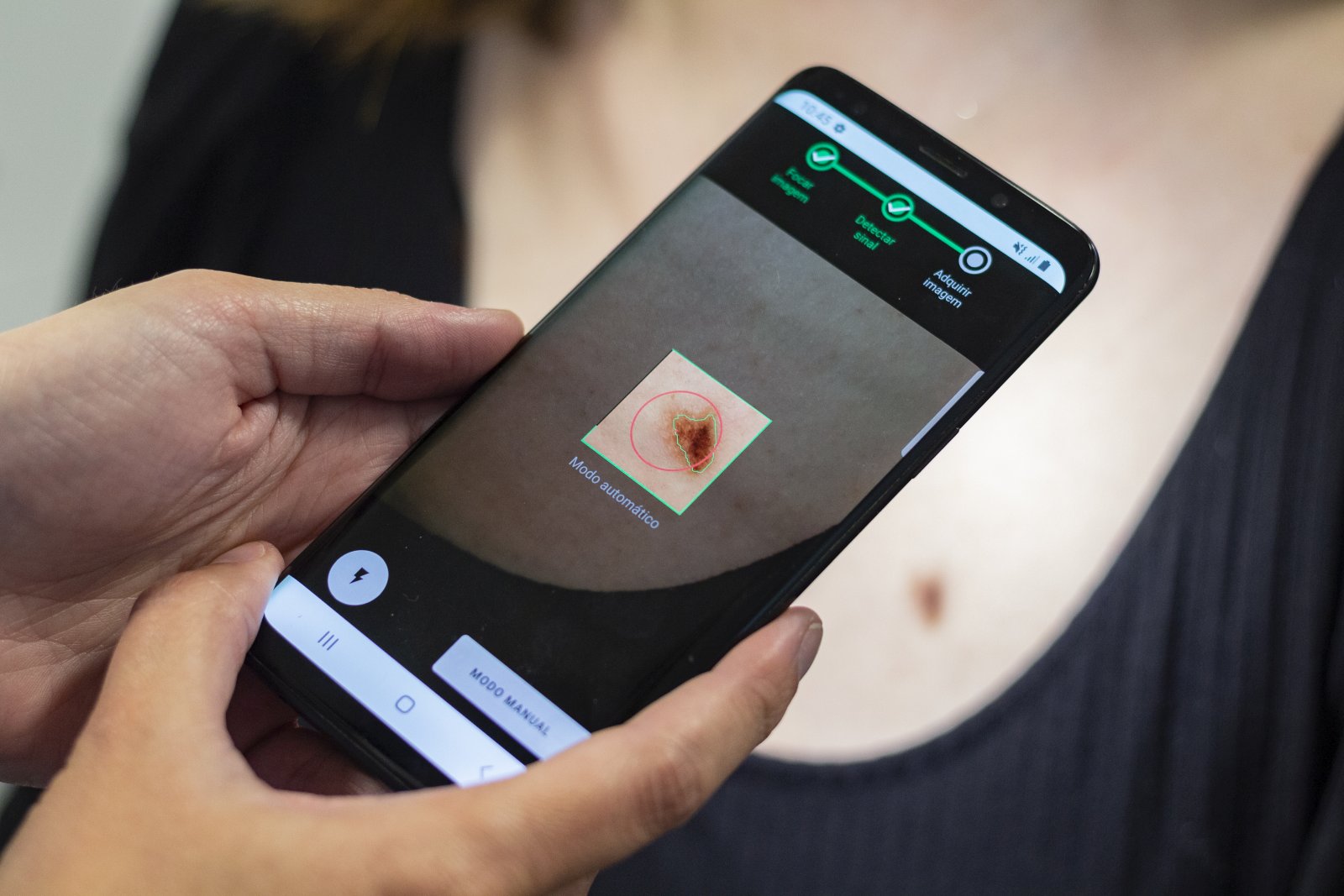 Die Smartphone-App von Derm.AI fotografiert verdächtige Flecken auf der Haut mit genau definierten und standardisierten Einstellungen.
