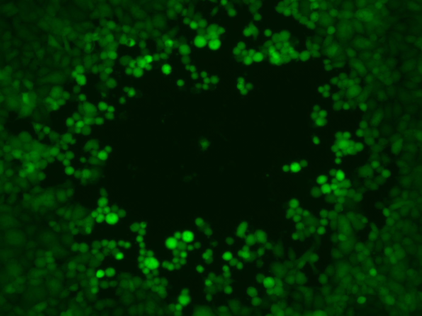 Plaquebildung von Zellkulturzellen durch einen engineerten, grün fluoreszierenden Herpes-simplex-Virus 1. Durch Vermehrung eines einzelnen Virus entsteht lokal ein Lysehof (Plaque), der an den Rändern durch noch lebende Zellen leuchtet.