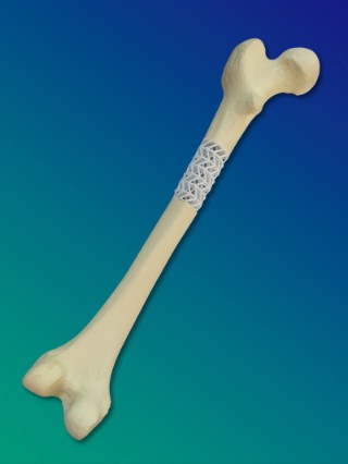 Das Scaffold im Projekt SCABAEGO lässt sich auf alle großen Röhrenknochen individuell anpassen. Die Anpassung erfolgt auf Basis eines CT des Knochens durch additiven 3D-Druck.