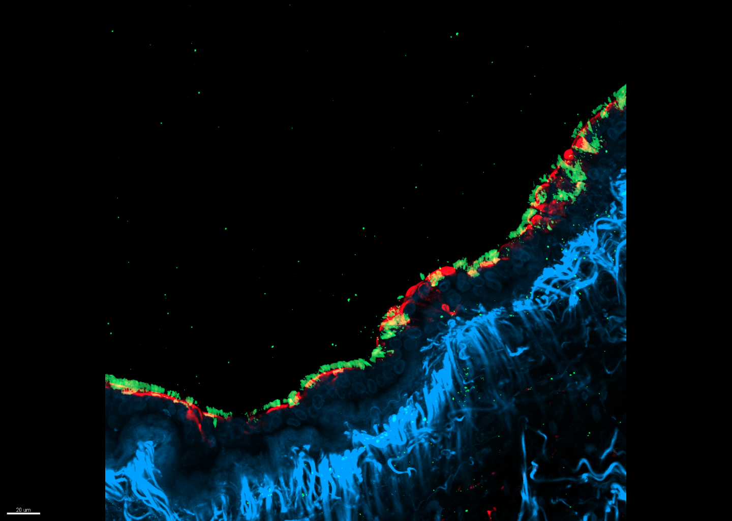 Die Wirksamkeit der RNAi-Wirkstoffkandidaten wurde in vitro erfolgreich an menschlichen Präzisionslungenschnitten getestet, die mit Parainfluenza-Viren (rot) infiziert waren. Die Zellkerne sind in Blau und Zilien in Grün dargestellt.