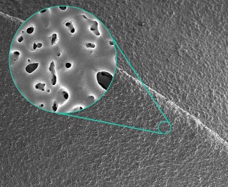 Rasterelektronenmikroskopische Aufnahme einer Silber-dotierten porösen MicroArc-Oxidschicht auf Titan