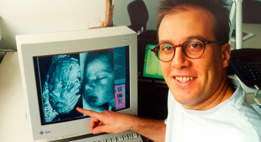 Joseph-von-Fraunhofer-Preis 1996: Dr. Georgios Sakas vom Fraunhofer-Institut für Graphische Datenverarbeitung IGD erhielt den Preis für ein System zur 3D-Ultraschalltomographie auf der Basis konventioneller 2D-Ultraschallgeräte