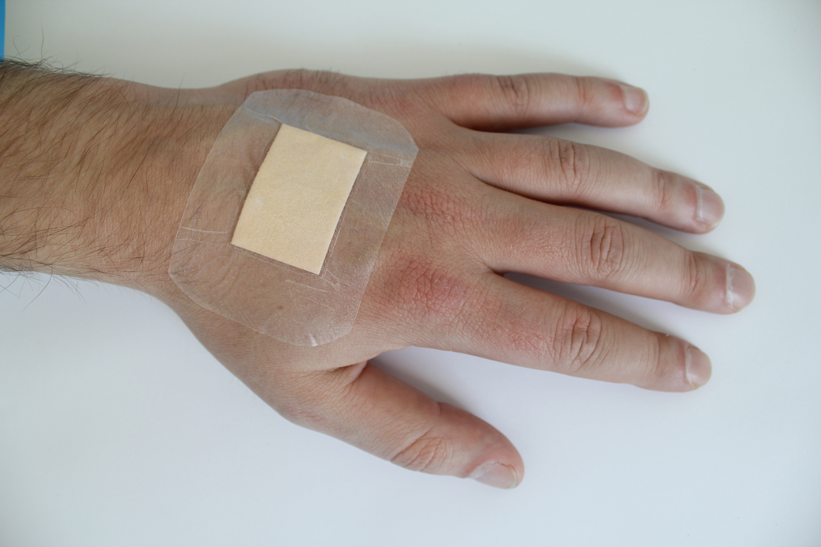 Verband zeigt Infektionen an
