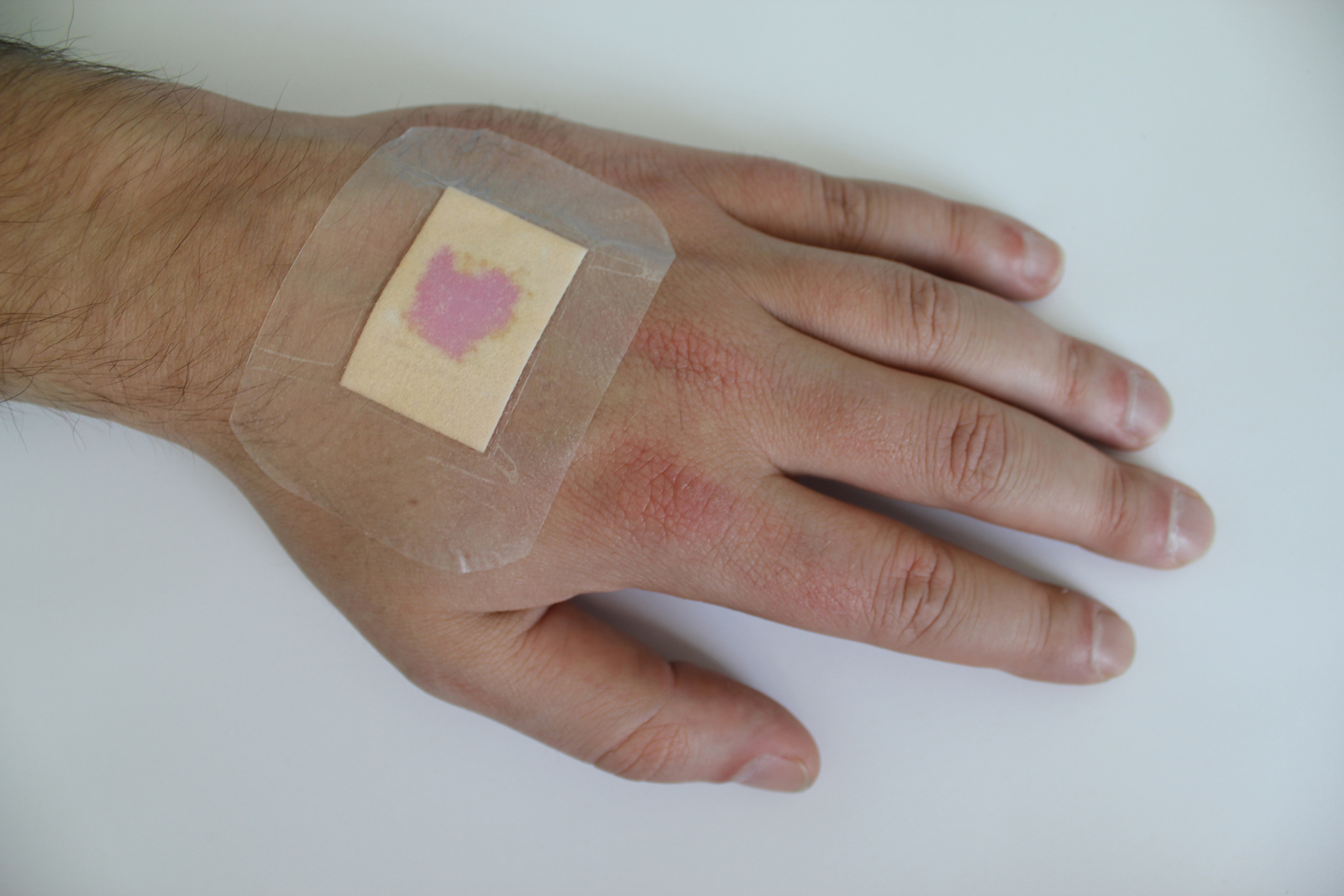 Verband zeigt Infektionen an