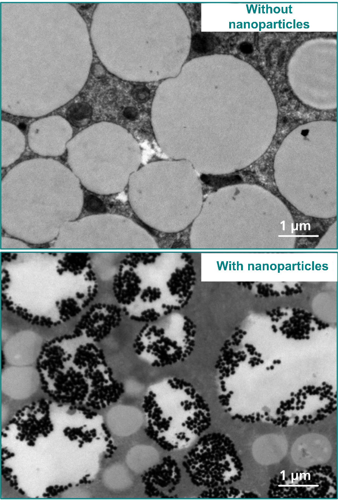 Detail of a microscopic image of a human lipid cell: untreated at the top, treated with gold nanoparticles at the bottom. The particles accumulate in the lipid droplets of the cell.