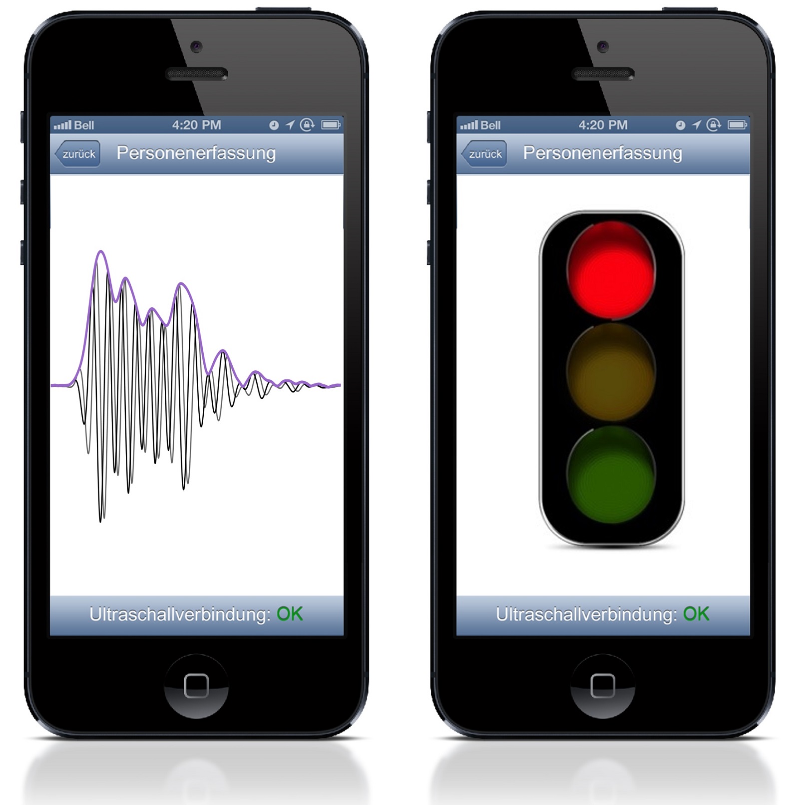 Ultrasound measurement data is transmitted to a smartphone, where it is analysed to determine a person’s age (illustration).