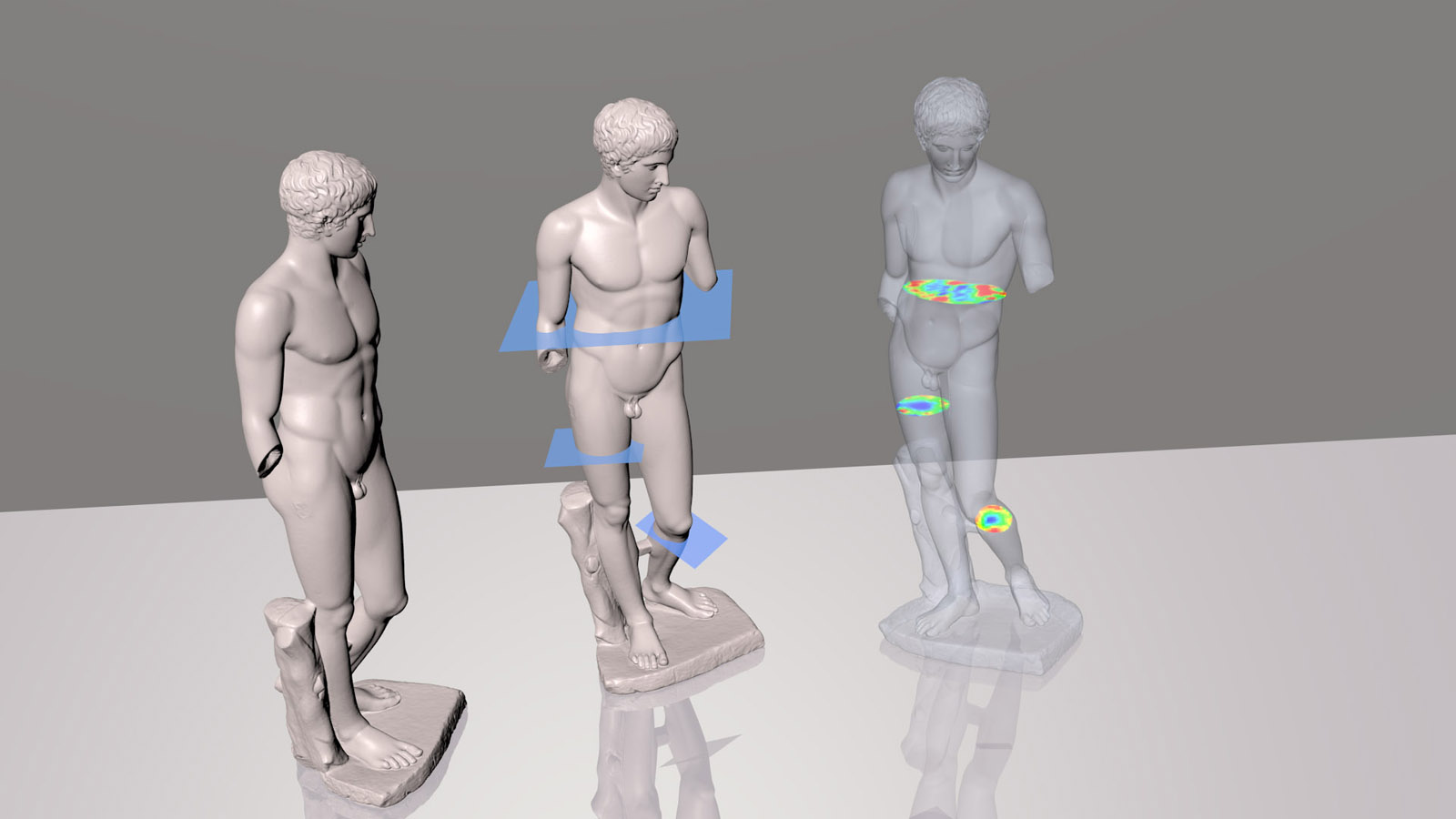 Combining surface scanning and ultrasound tomography. 