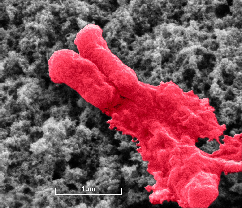 Antibiotic coating lyses bacterium (E. coli).