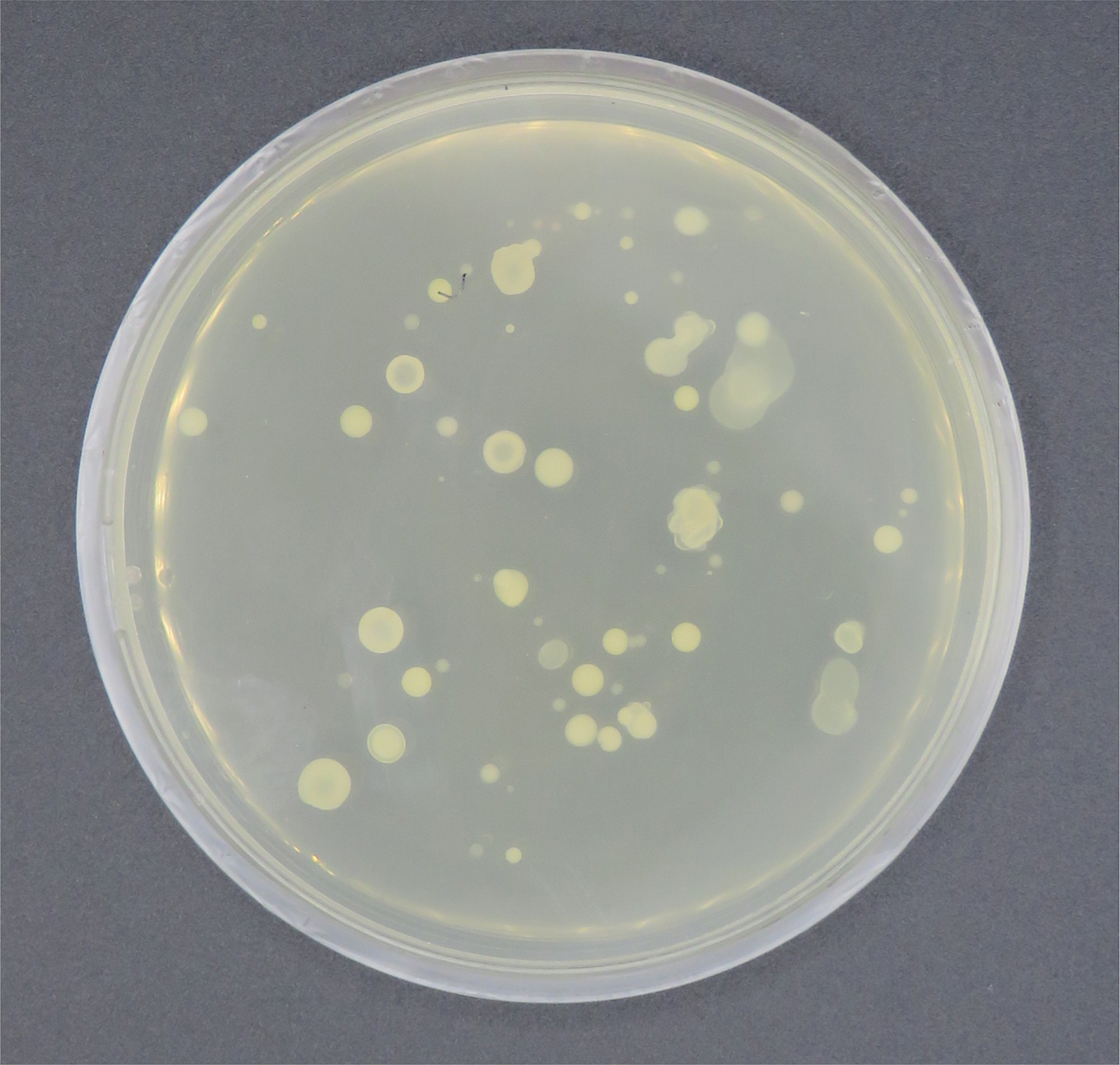 The bacterial culture is plated out in a nutrient medium.