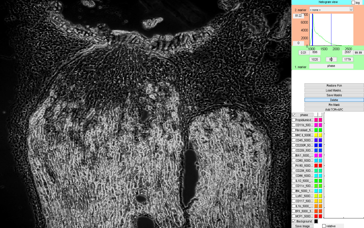 Transmitted light image of an injured sciatic nerve.