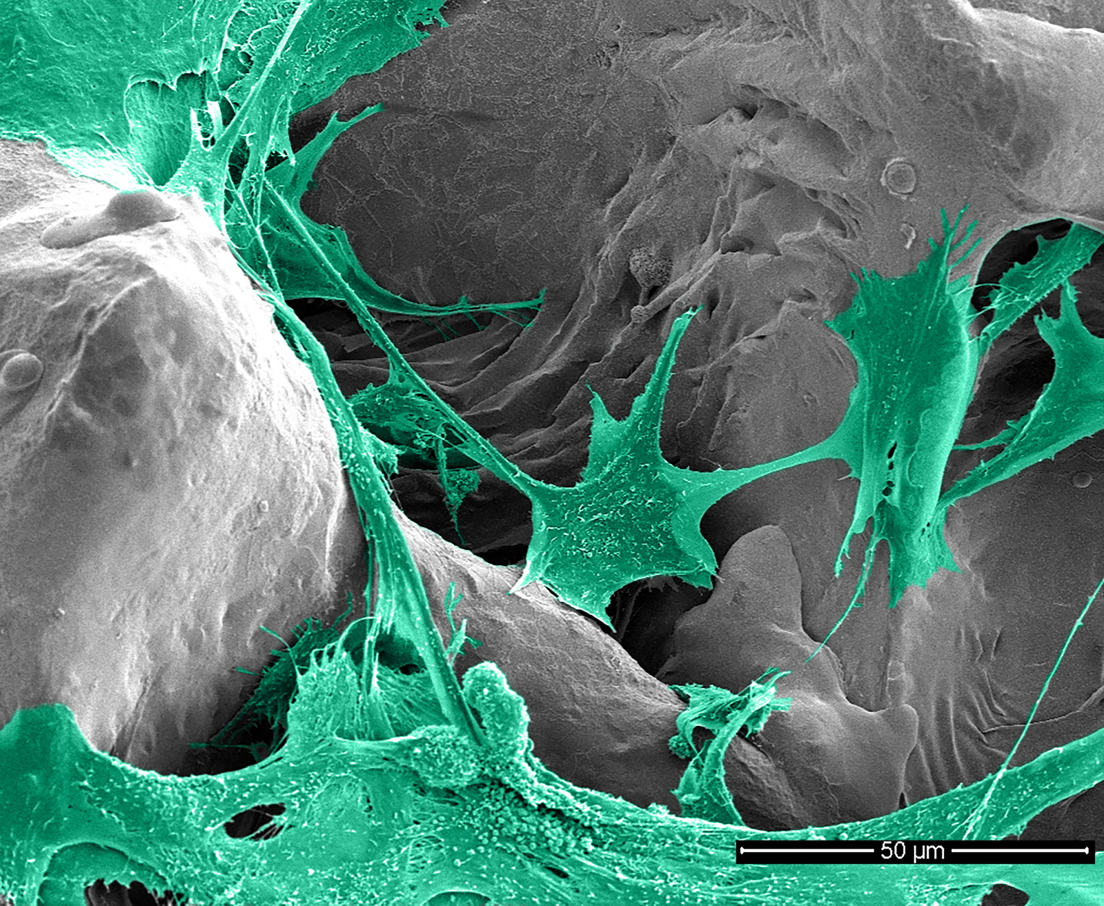 A hybrid implant coating made from antibacterial silver and an antibiotic will protect patients from infection in the future. The antibiotic is tailored to the patient’s unique requirements for even better protection. The AntiSelectInfekt project came about in collaboration with a research team from Charité-Universtitätsmedizin Berlin.