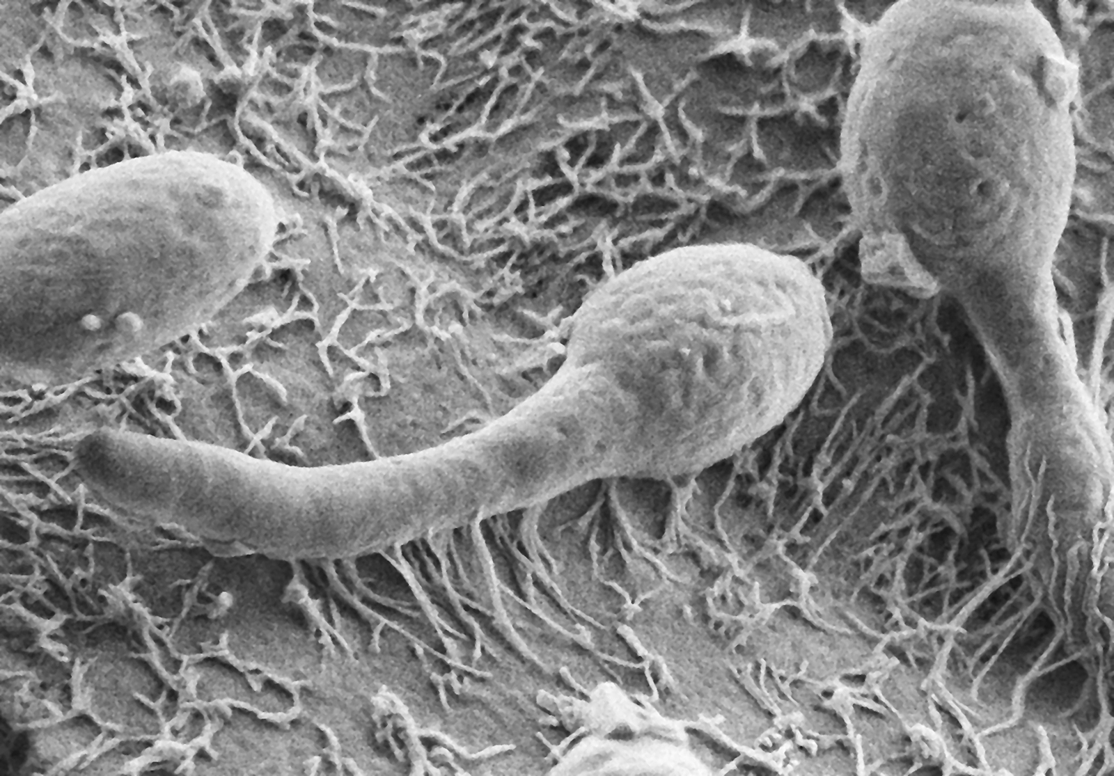 The fungus Candida albicans on intestinal cells as seen under the microscope.