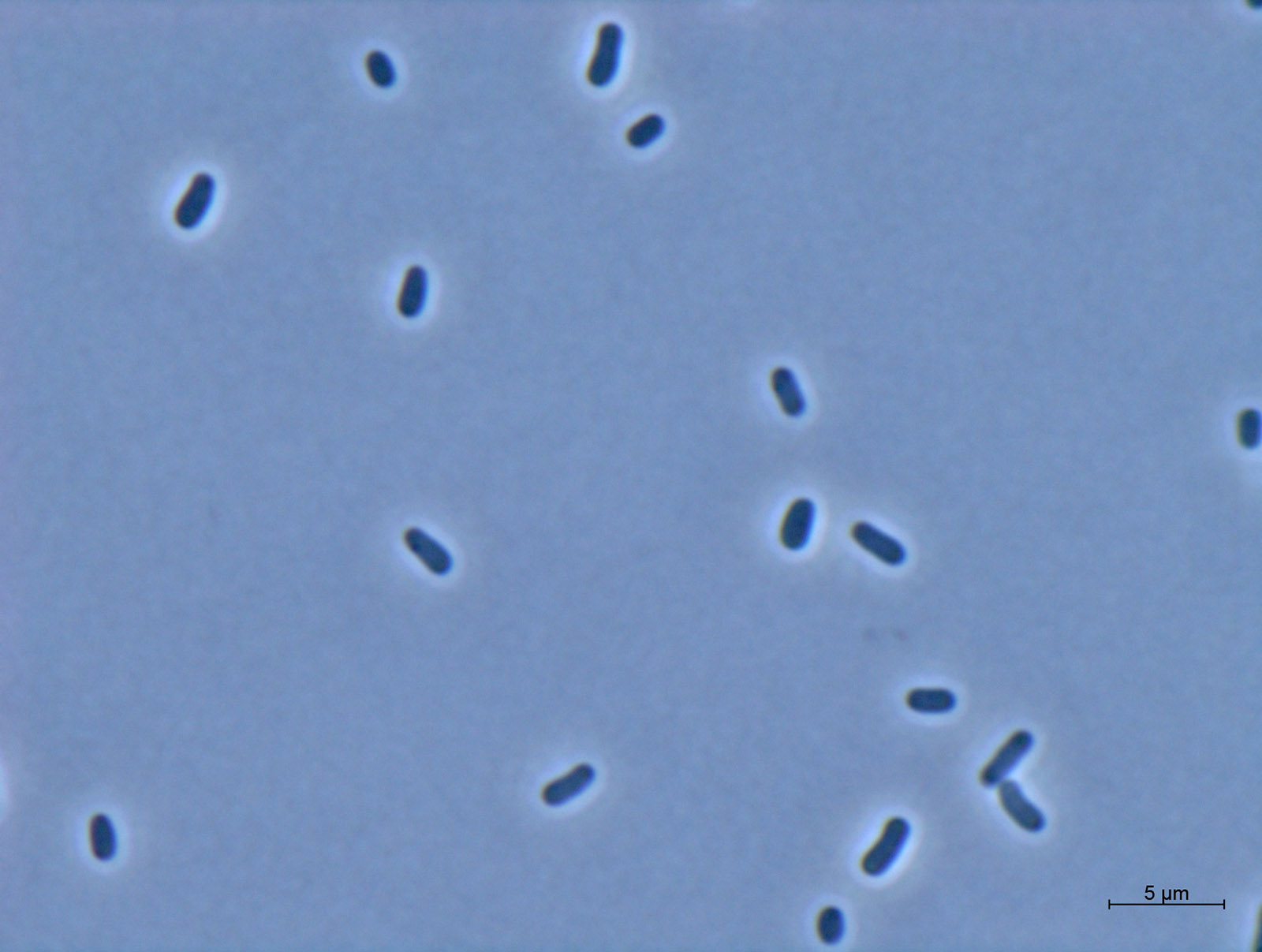 Light micrograph of cells of the gram-negative bacte-rium Methylorubrum extor-quens AM1.