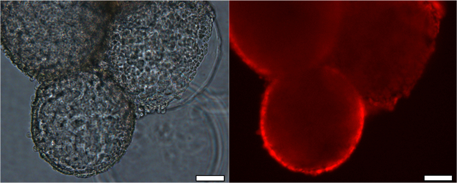 Adherent iPS cells on alginate microcarriers after successful cultivation (left: backlit phase contrast image, right: fluorescent image of pluripotency marker Oct-4, scale: 100 µm).