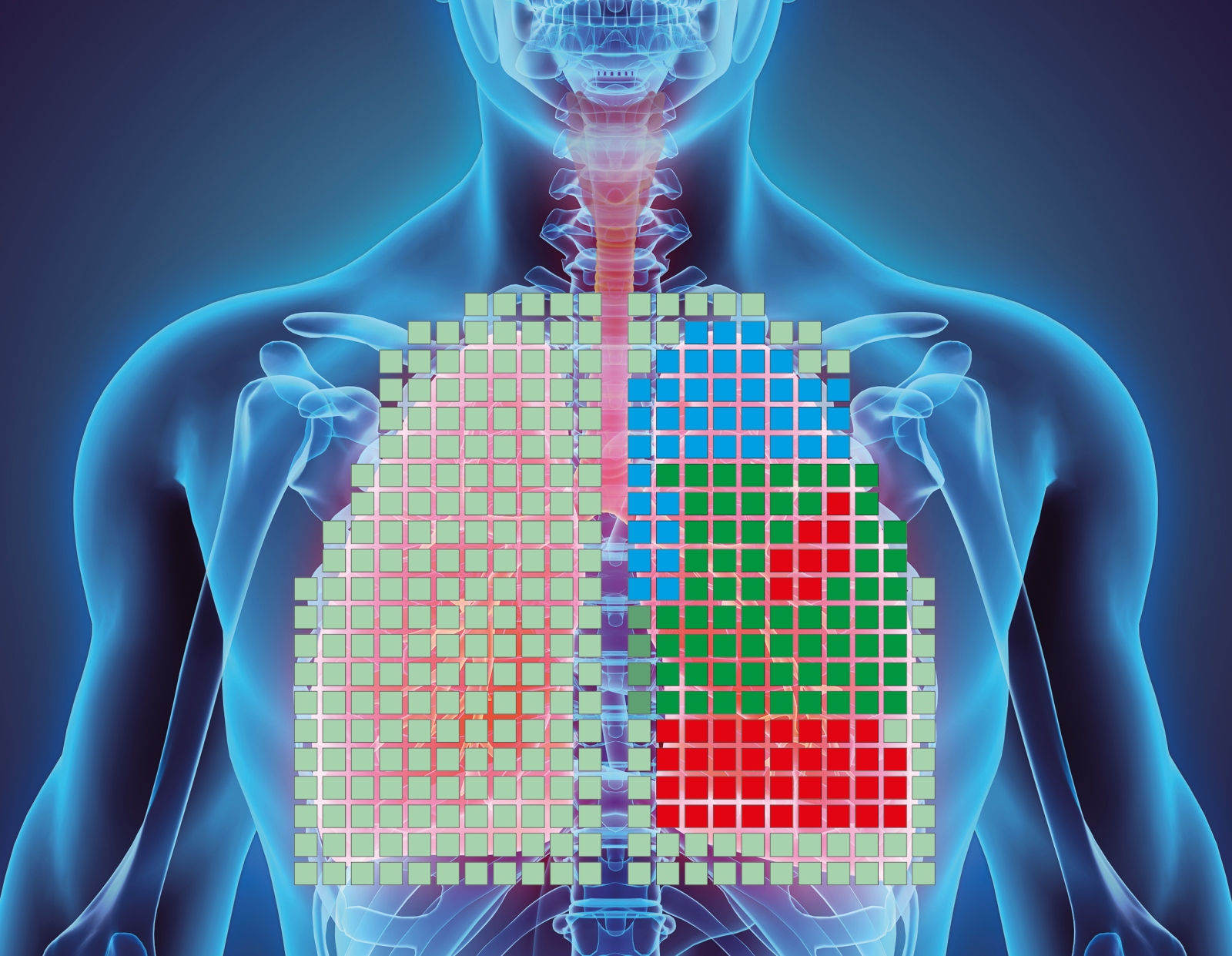 The visual representation shows the different lung areas and their ventilation situation. Parts marked in red have poor ventilation.