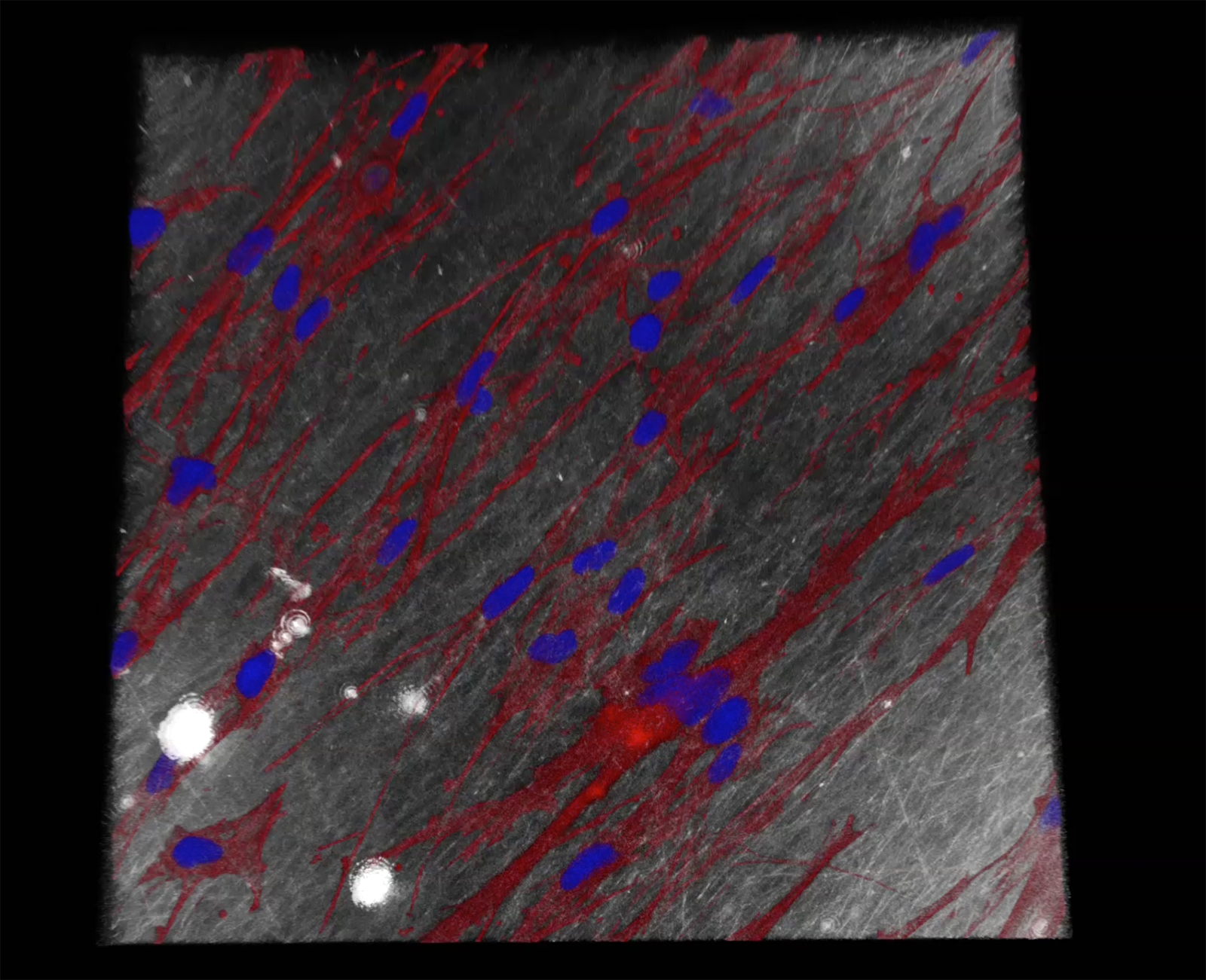 Fibroblasten (Bindegewebszellen) auf der elektroversponnenen Renacer®-Membran unter dem Konfokalmikroskop (rot: Zytoskelett der Zellen, blau: Zellkerne)