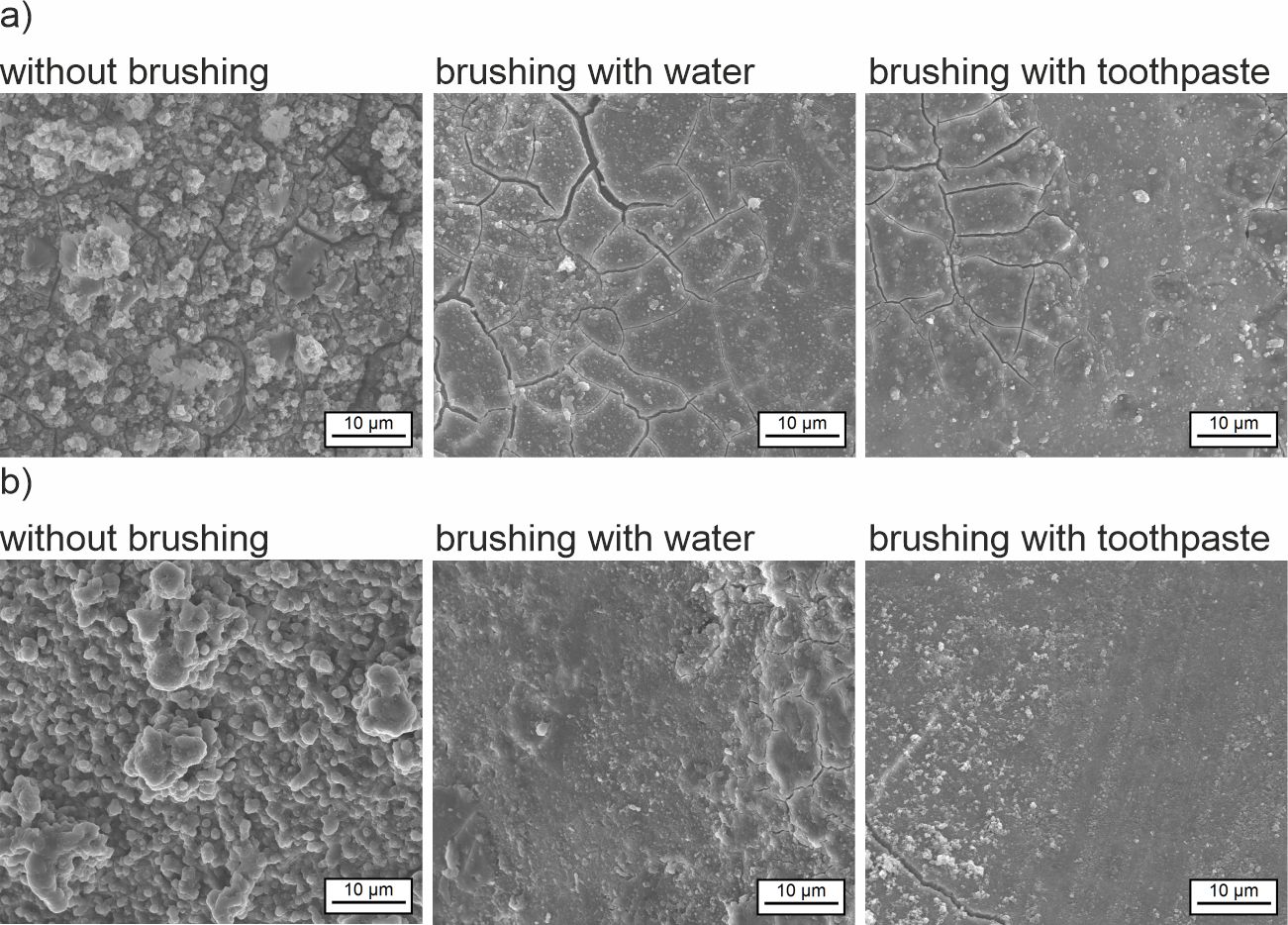 After drinking pure black tea (a) during CHX treatment, significantly stronger staining can be seen under the scanning electron microscope in comparison to drinking the beverage diluted with milk (b). 