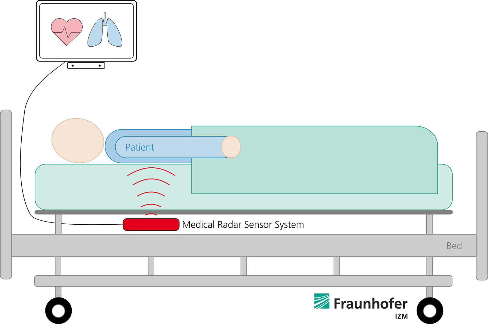 レーダーによる非接触型心電モニタリング(Contactless Patient Monitoring ― ECG using Radar)