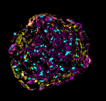 心臓オルガノイドで薬剤の心毒性を評価(Miniature Hearts: Cardiac Organoids With an Immune System)