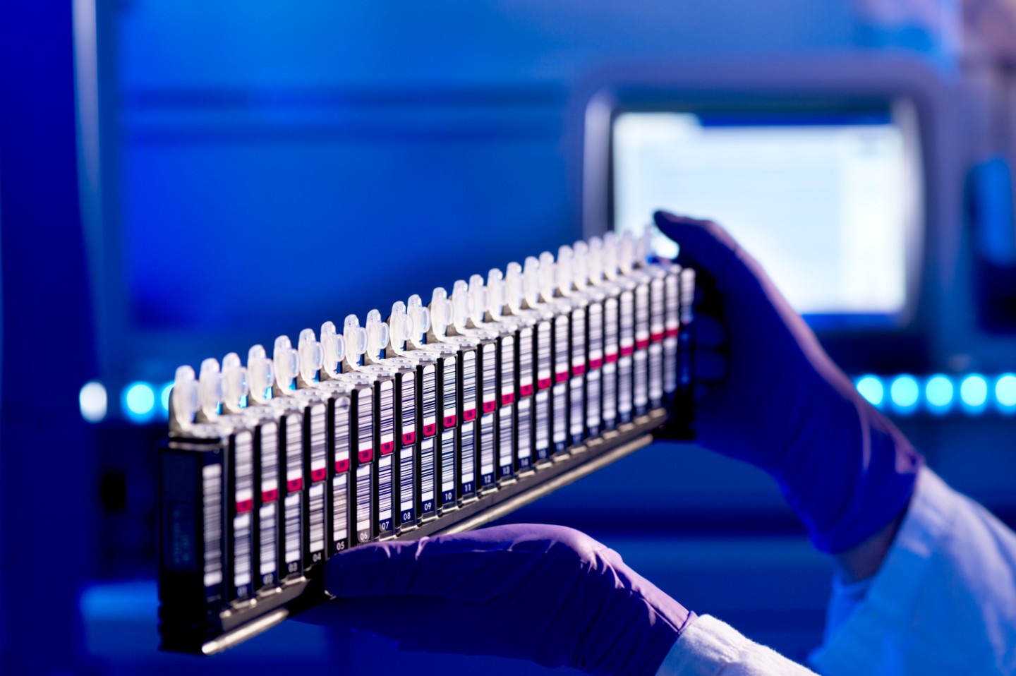 In diagnostics using high-throughput sequencing, the institute has extensive experience in the indications sepsis, endocarditis, amniotic fluid infections, but also in microbiome studies.