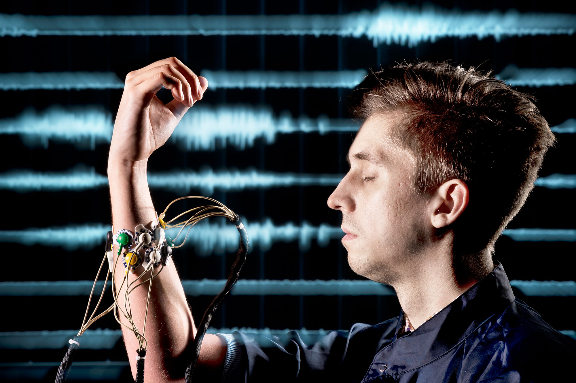 As Dmitry Amelin concentrates on the movement of his hand, electrodes measure the muscle impulses that could serve to control a prosthetic hand. 